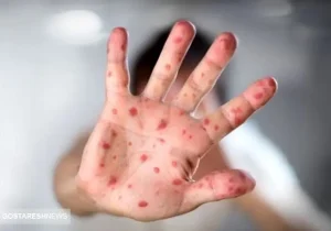 هشدار بیماری | اتباع افغان و پاکستان سوغاتی تازه آوردند !