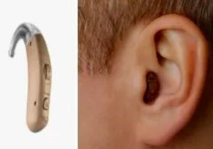 قرار گرفتن ایران در جمع ۱۰ کشور دارنده فناوری سمعک دیجیتال