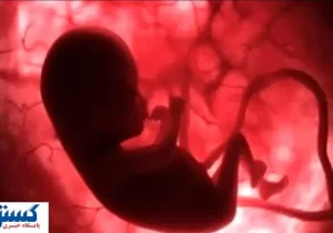 دولت شرایط سقط جنین قانونی را اعلام کرد | کدام روش بهتر است د؟