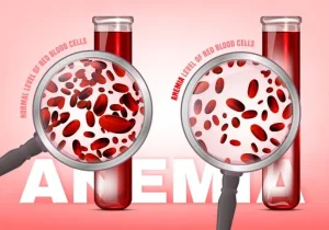 علائم هشداردهنده کم‌خونی شدید | چه زمانی باید به پزشک مراجعه کرد؟