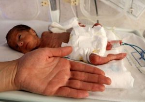 ترخیص نوزاد ۷۰۰ گرمی پس از ۴۸ روز تلاش شبانه‌روزی کادر درمان