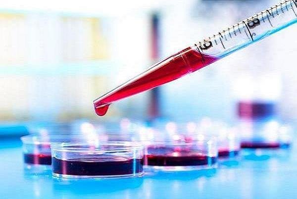 آزمایش خون میتواند بیماری کرون را پیشبینی کند