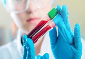 چقدر احتمال دارد مبتلا به سرطان شویم