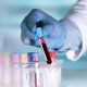تاثیر آزمایش خون مبتنی بر DNA بر درمان سرطان گلو