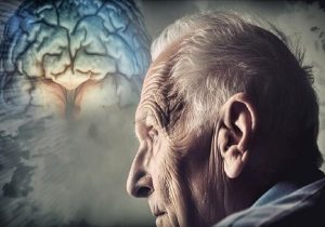 ارتباط سکته خفیف با افزایش ۳۴ درصدی زوال عقل در درازمدت
